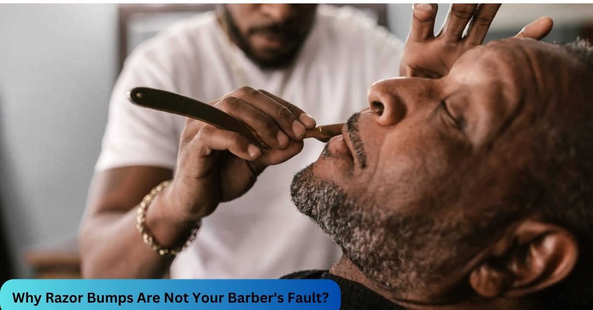 Why Razor Bumps Are Not Your Barber's Fault