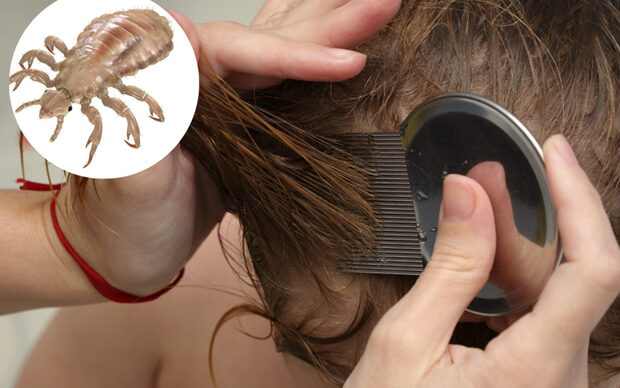 Can lice spread after treatment?