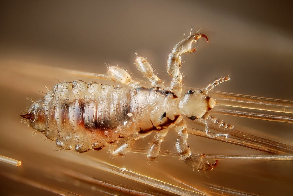 Some Precautions and Symptoms to Get Rid of Lice and Lice Eggs?